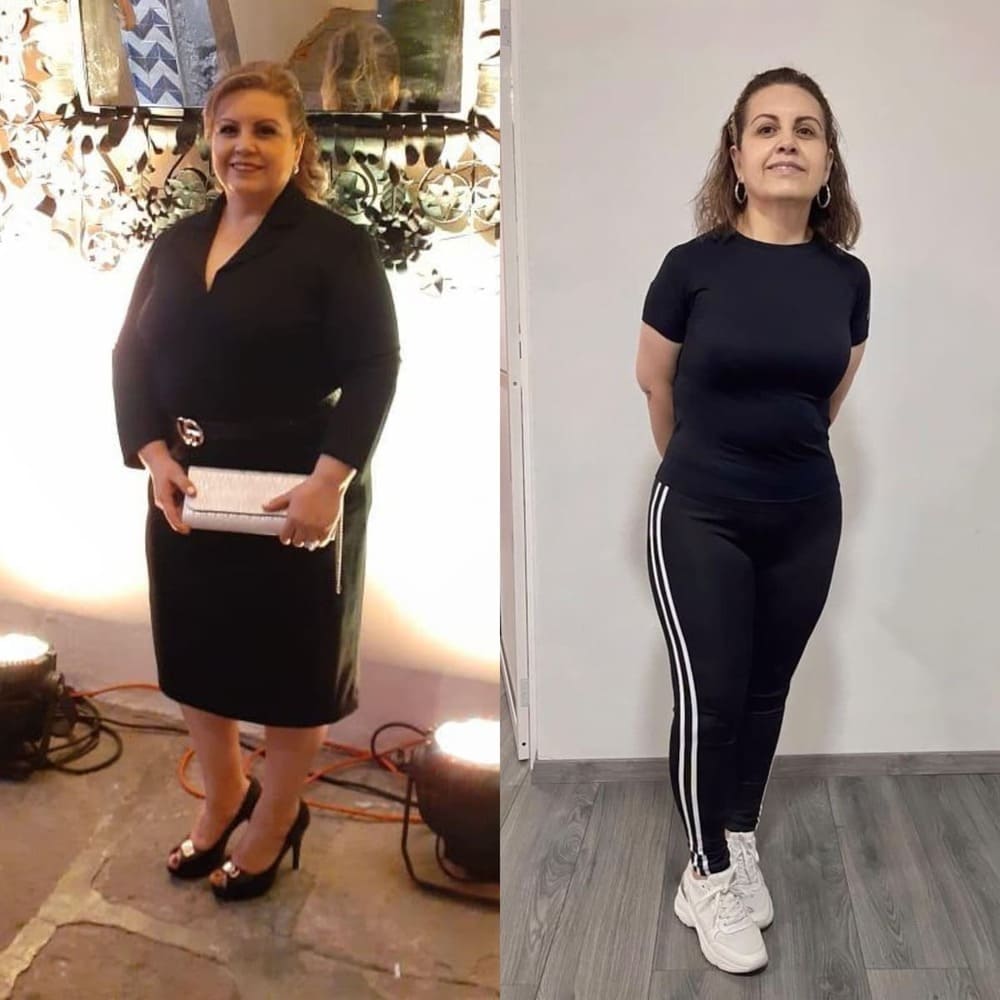 Resultado de paciente — antes y después
