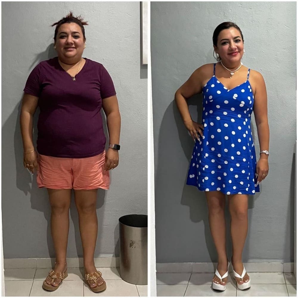 Resultado de paciente — antes y después