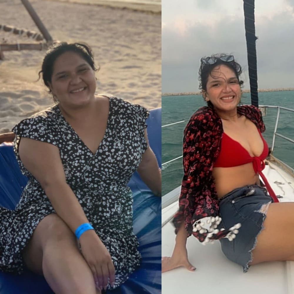 Resultado de paciente — antes y después