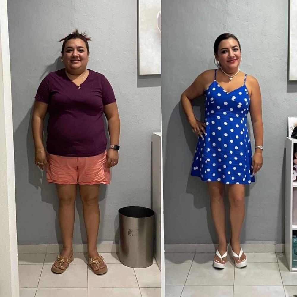 Resultado de paciente — antes y después