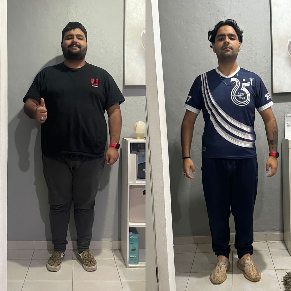 Resultado de paciente — antes y después