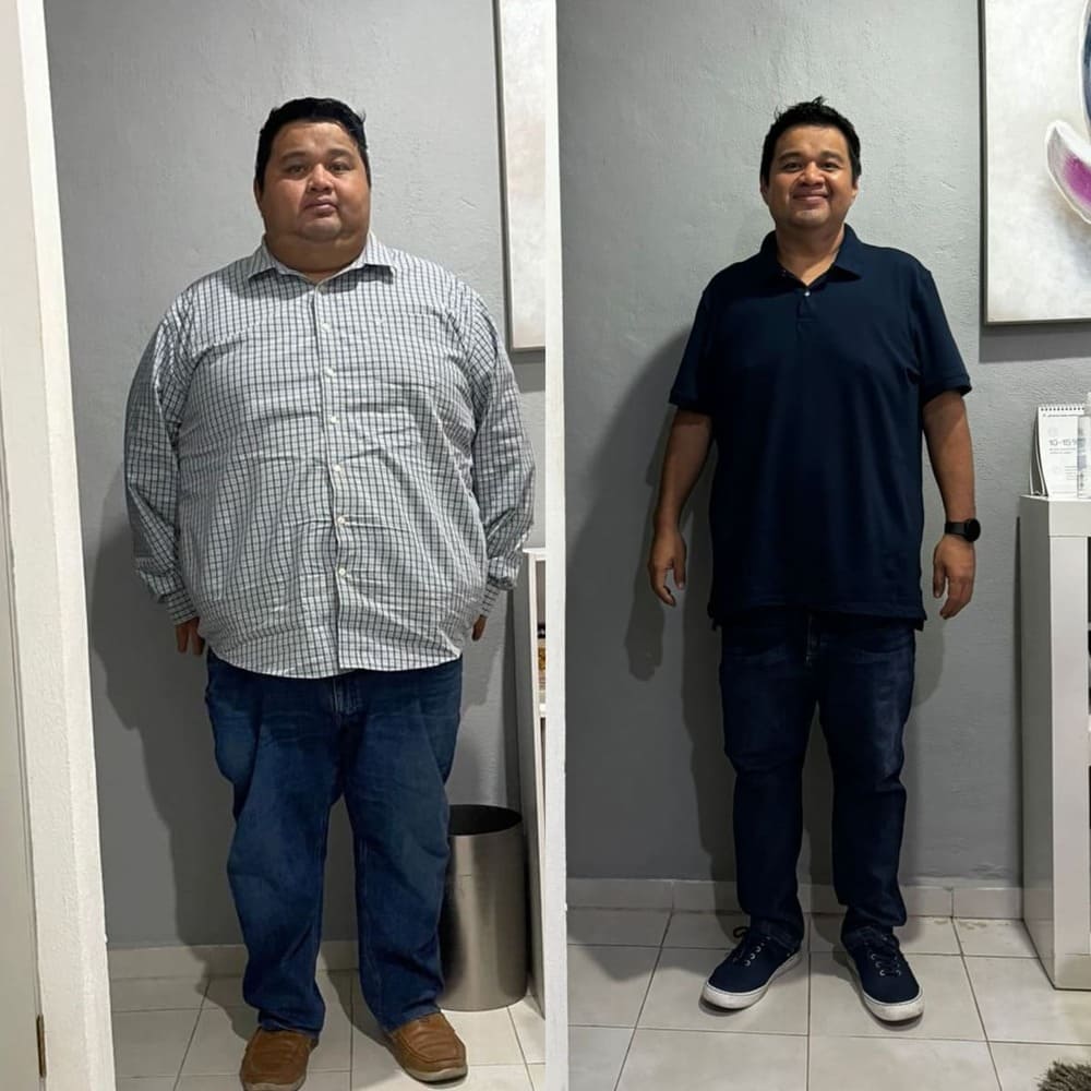 Resultado de paciente — antes y después
