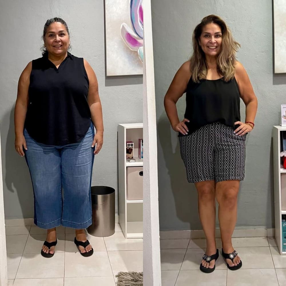 Resultado de paciente — antes y después