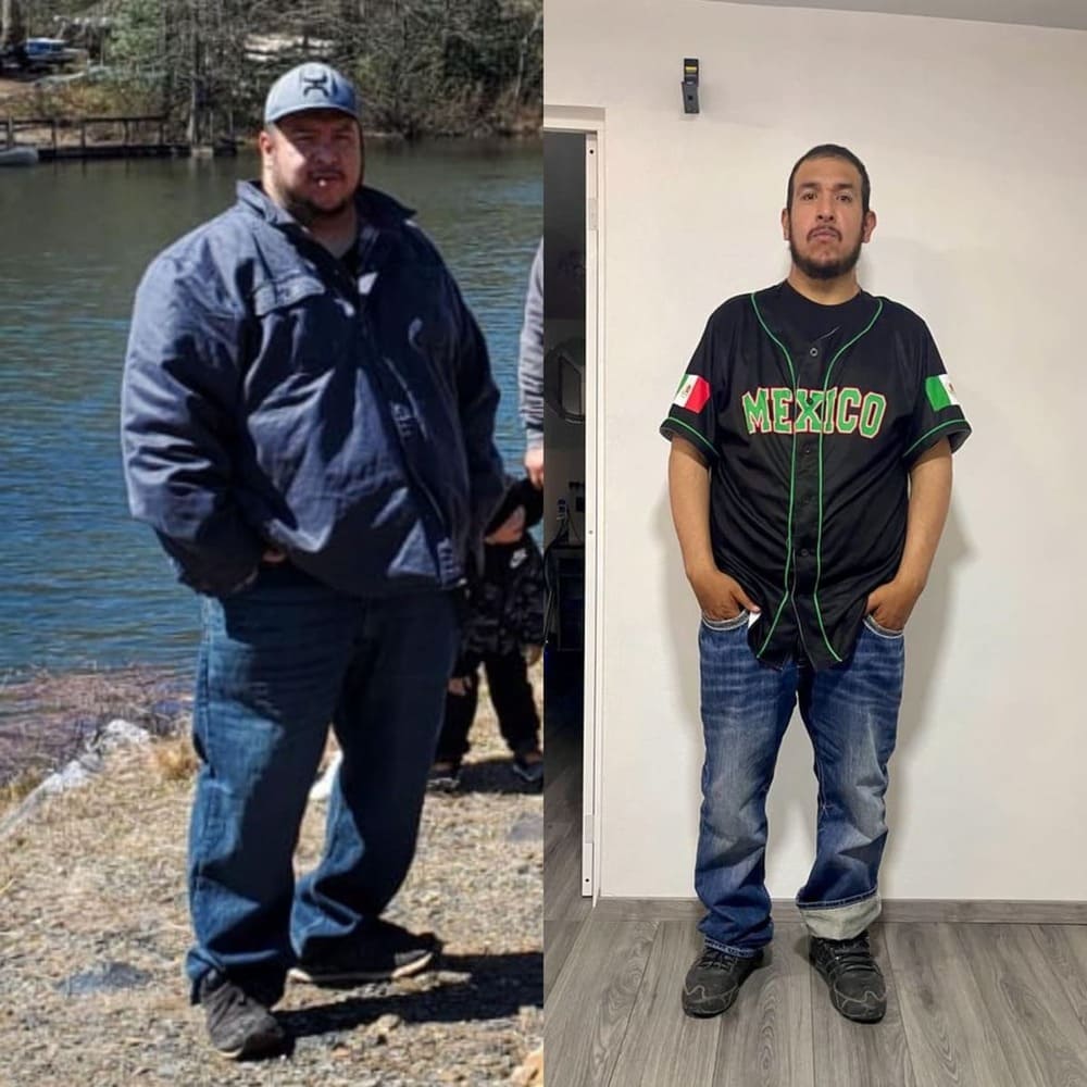Resultado de paciente — antes y después