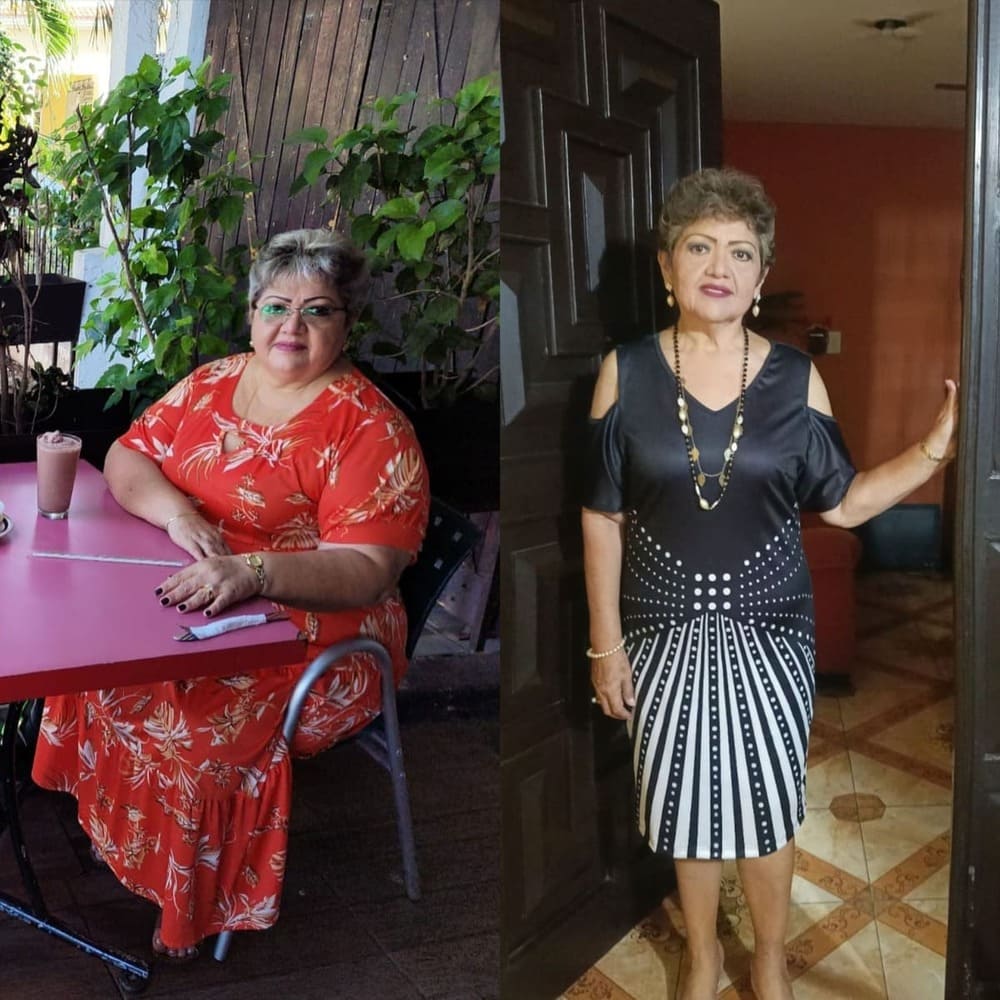 Resultado de paciente — antes y después