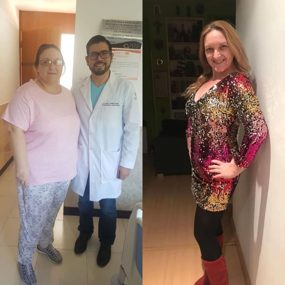 Resultado de paciente — antes y después