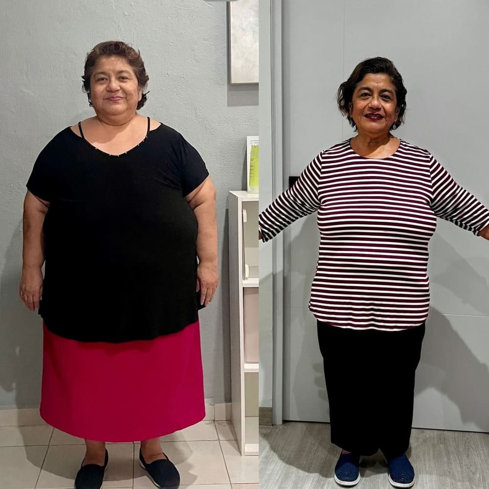 Resultado de paciente — antes y después