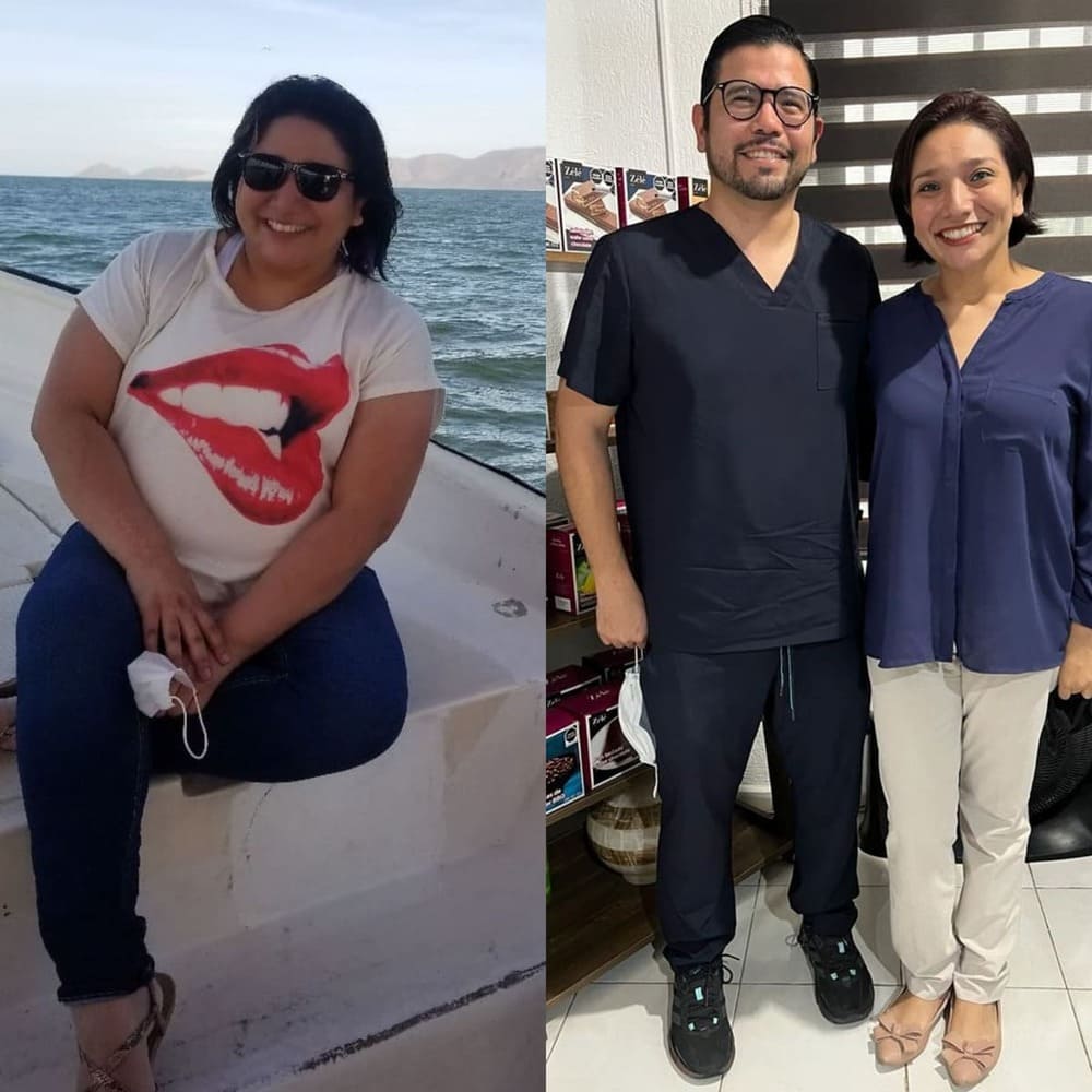 Resultado de paciente — antes y después
