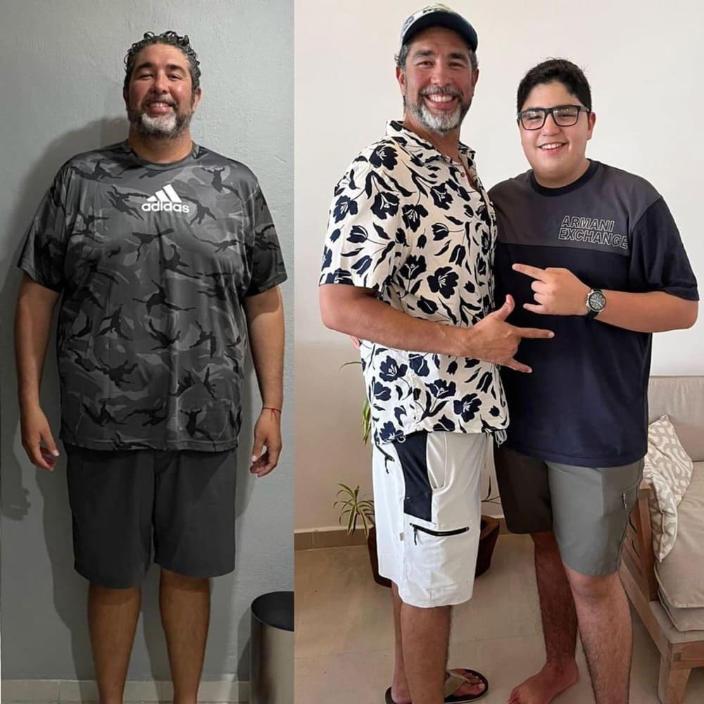 Resultado de paciente — antes y después
