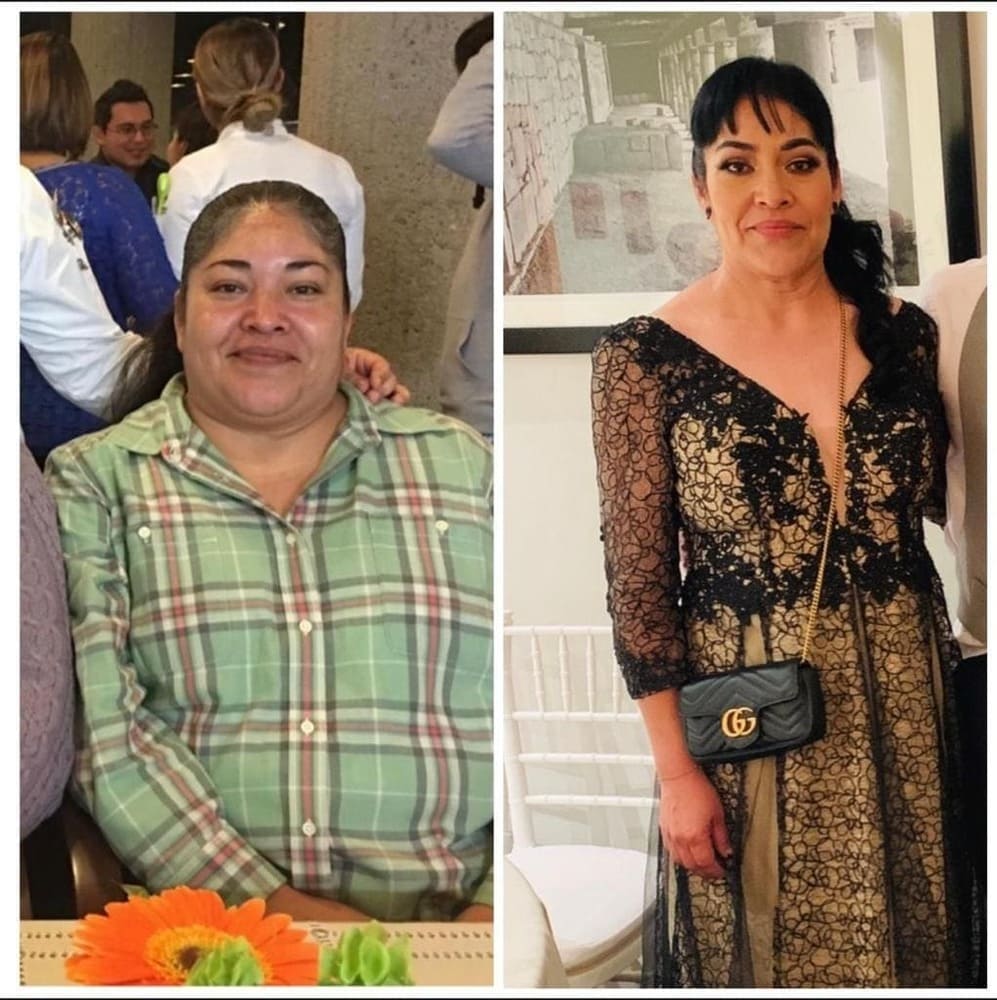 Resultado de paciente — antes y después